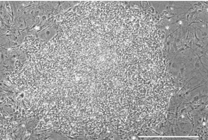 شناسایی منبع پایدار سلول‌های ایمنی مقاوم به ویروس نقص ایمنی توسط پژوهشگران